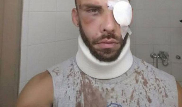 Το θύμα της επίθεσης