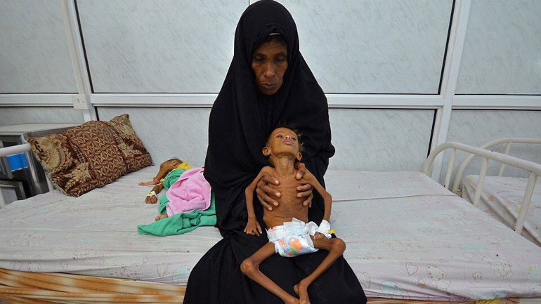 UNICEF: 15.000 παιδιά κάτω των πέντε ετών πεθαίνουν καθημερινά