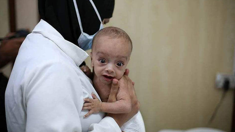 Συρία: Κίνδυνος λιμού στην ανταρτοκρατούμενη Ανατολική Γούτα της Δαμασκού