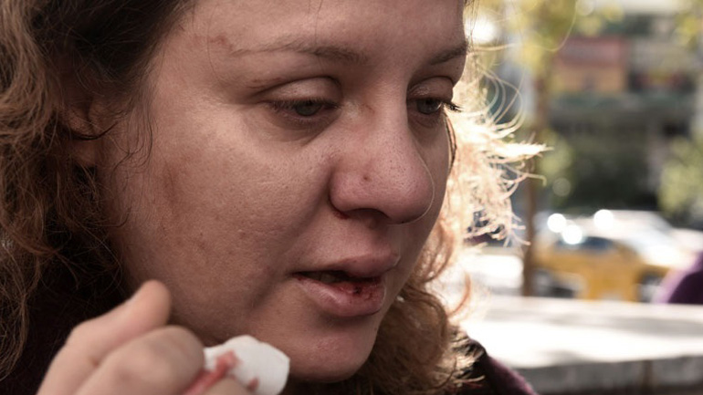 ΔΣΑ: Καταδίκη και αποτροπιασμός για την επίθεση εναντίον της δικηγόρου Ευγ. Κουνιάκη