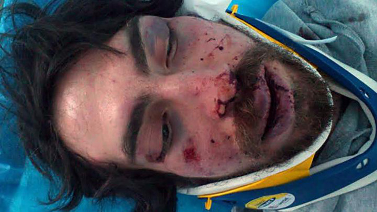 Ποινή κάθειρξης 7 ετών στον υπάλληλο της Χρυσής Αυγής Χρ. Ζέρβα, για την επίθεση σε βάρος φοιτητή