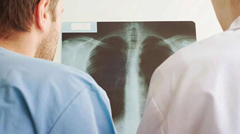 Χρόνια αποφρακτική πνευμονοπάθεια: O «άγνωστος» δολοφόνος της Ευρώπης