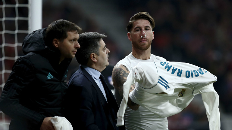 Χωρίς Ράμος κόντρα στον ΑΠΟΕΛ η Ρεάλ Μαδρίτης