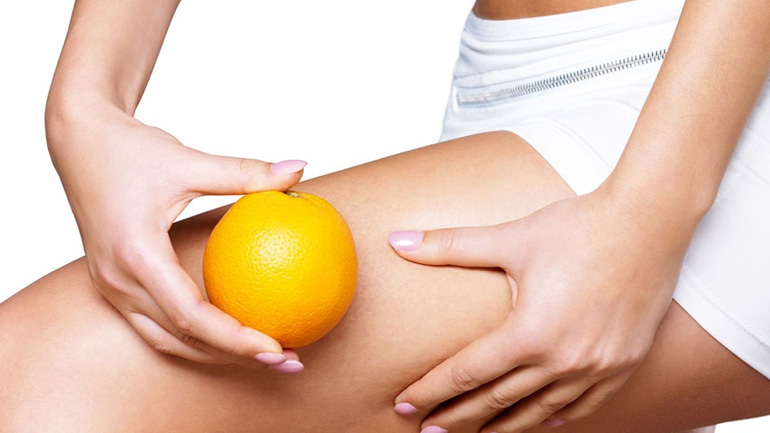 Τι ευθύνεται τελικά για την κυτταρίτιδα στο σώμα μας;