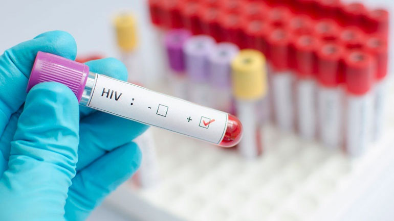 ΠΟΥ: Ο ιός HIV εξαπλώνεται με ανησυχητικά γρήγορους ρυθμούς στην Ευρώπη