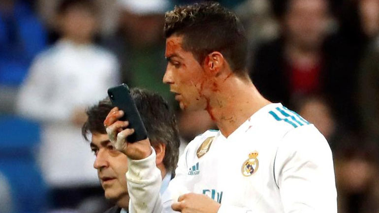 Ασπίδα προστασίας Ζιντάν στον Κριστιάνο Ρονάλντο