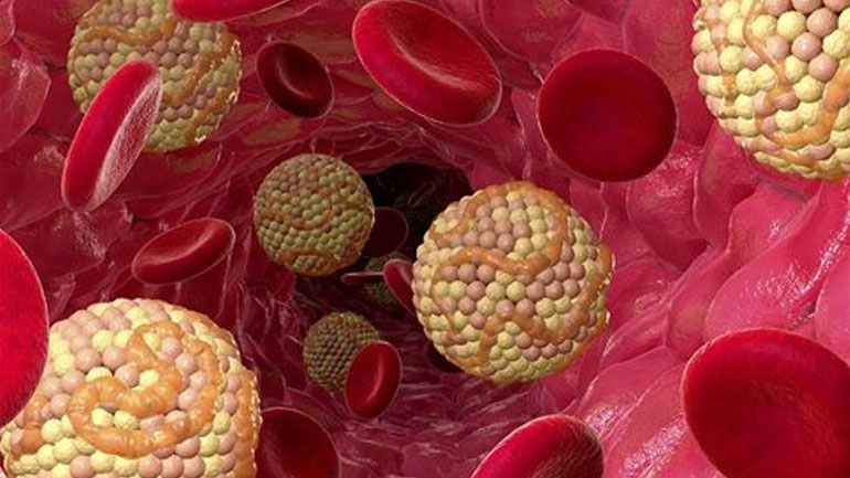 Πώς η χοληστερόλη μπορεί να καταστρέψει τη σεξουαλική ζωή