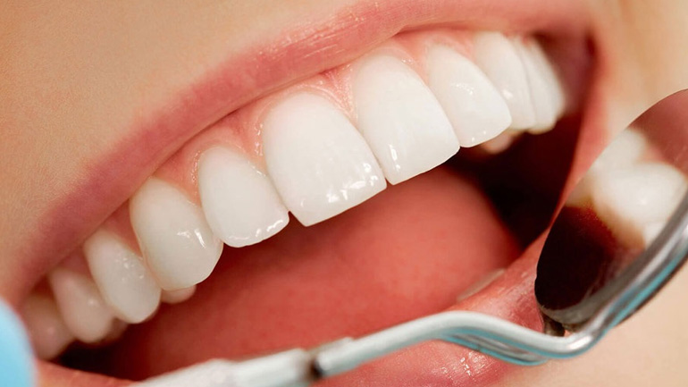 Κι όμως αυτές οι συνήθειες κιτρινίζουν τα δόντια μας!