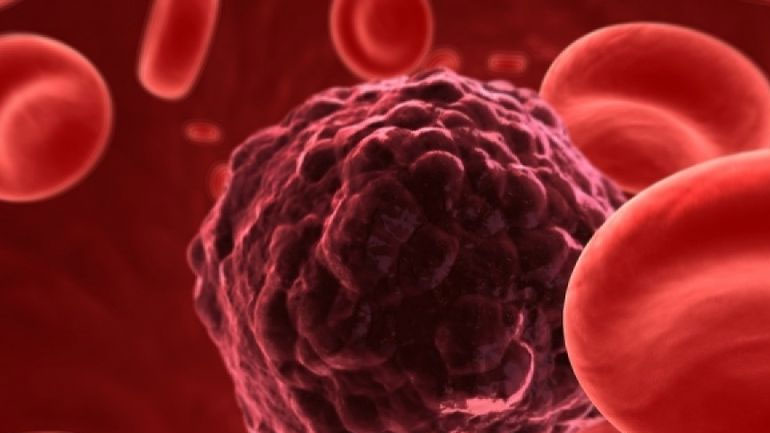 Η επιβίωση από τον καρκίνο βελτιώνεται παγκοσμίως