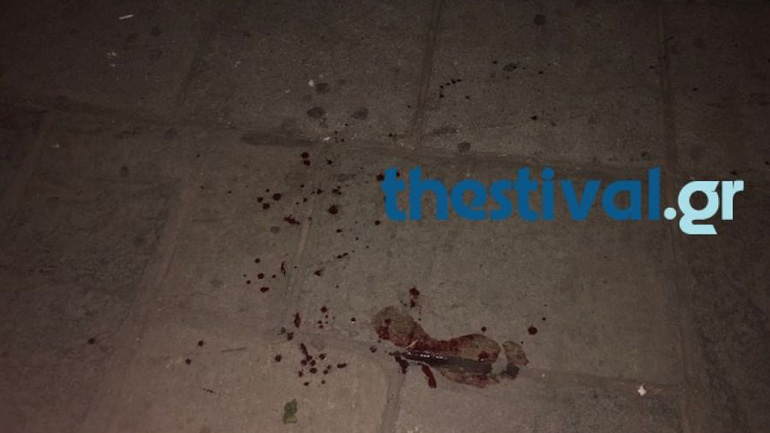 Θεσσαλονίκη: Αιματηρό επεισόδιο στο κέντρο της πόλης με θύμα 25χρονο που νοσηλεύεται εκτός κινδύνου