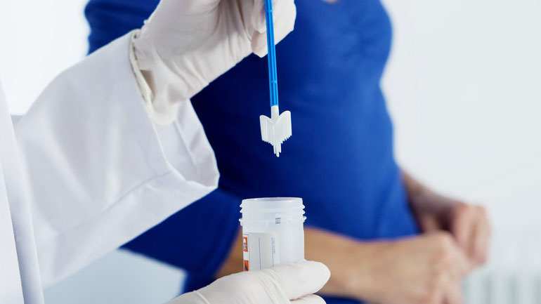 Μόνο το 35% των Ελληνίδων υποβάλλεται τακτικά σε τεστ Παπ