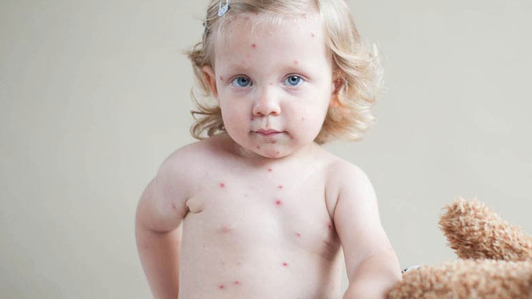 Όλα όσα πρέπει να γνωρίζετε για την ανεμοβλογιά