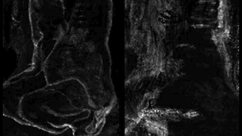 Ερευνητές ανακάλυψαν το κρυφό έργο άλλου ζωγράφου κάτω από πίνακα του Πικάσο