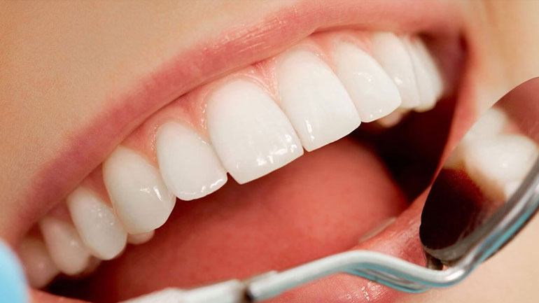 Κι όμως αυτές οι συνήθειες κιτρινίζουν τα δόντια μας! Κι όμως αυτές οι συνήθειες κιτρινίζουν τα δόντια μας!