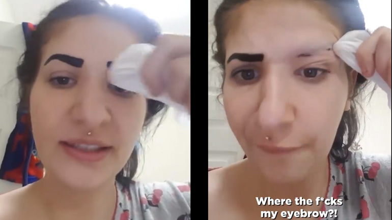 Η βαφή της έκαψε τα φρύδια