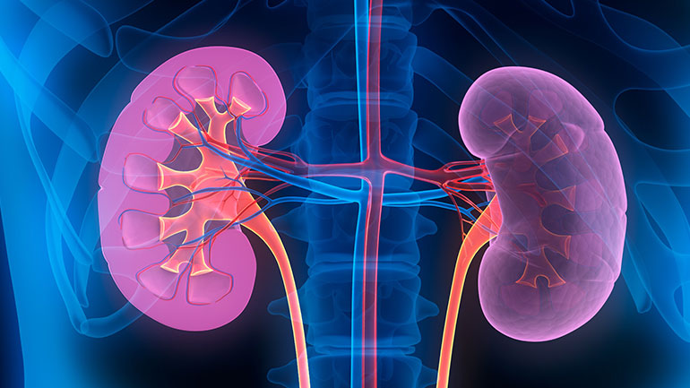 Ένας στους δέκα ενήλικες πάσχει από κάποιου βαθμού χρόνια νεφρική νόσο