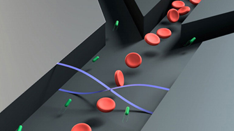 Το πρώτο απλό τεστ διάγνωσης της σήψης από μία μόνο σταγόνα αίματος