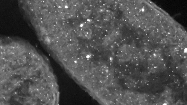 Τα ρούχα του μέλλοντος θα… σκοτώνουν τα μικρόβια!