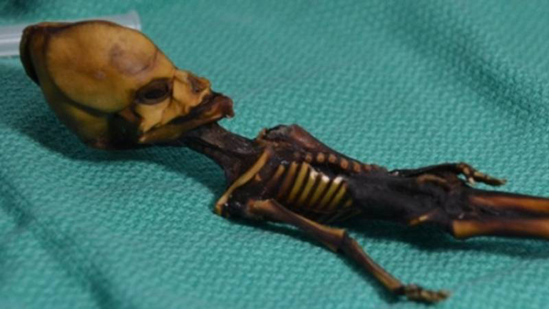 Ο «εξωγήινος» της χιλιανής ερήμου Ατακάμα ήταν τελικά… ένα κορίτσι