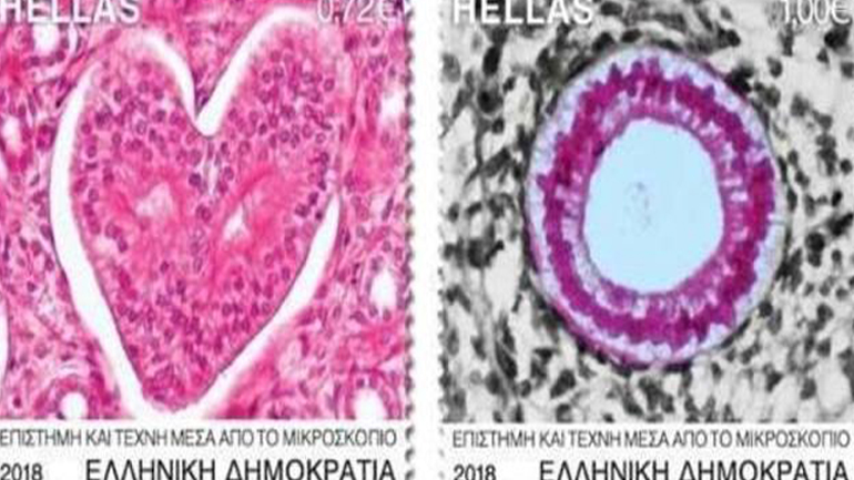 Τα  γραμματόσημα του μικροσκοπίου που μεταλλάσουν την ιατρική επιστήμη σε τέχνη