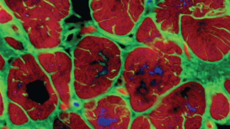 Δημιουργήθηκε ο πρώτος ώριμος ανθρώπινος καρδιακός μυς από βλαστοκύτταρα