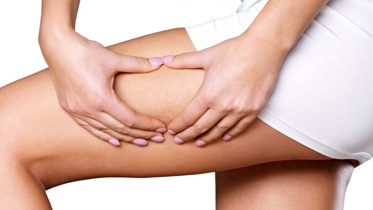 Πες «αντίο» στην κυτταρίτιδα με αυτές τις τροφές!