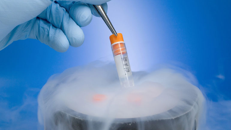 Κρυοσυντήρηση: Πόσα κατεψυγμένα ωάρια «εγγυώνται» την επιτυχία;