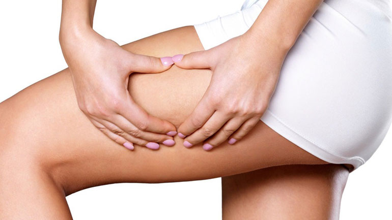 Πες «αντίο» στην κυτταρίτιδα με αυτές τις τροφές!