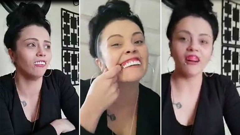 «Δεν μπορώ να τα βγάλω!» Έβαλε θήκη δοντιών και το μετάνιωσε πικρά!