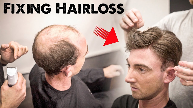 Πήγε καραφλός και βγήκε κουρεμένος