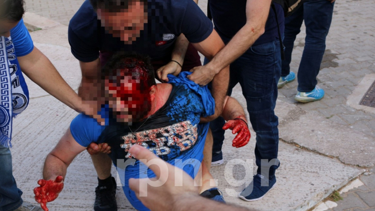 Επεισόδια μεταξύ οπαδών και ΜΑΤ στο ημίχρονο του αγώνα Αήττητου Σπάτων-Εθνικού Επεισόδια μεταξύ οπαδών και ΜΑΤ στο ημίχρονο του αγώνα Αήττητου Σπάτων-Εθνικού