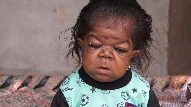 23χρονος παγιδευμένος σε σώμα μωρού