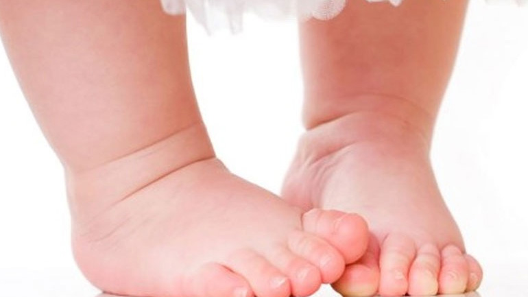 Το παιδί μου γυρίζει τα πέλματα προς τα μέσα