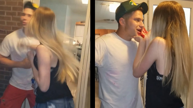 Τον χτύπησε τόσο σκληρά που μάτωσε πολύ άσχημα