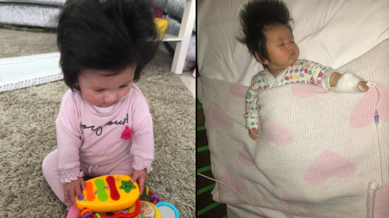 Το πιο… μαλλιαρό μωρό ever!