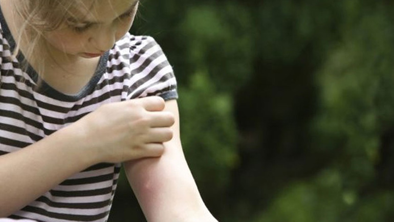 Πώς να προστατευτείτε από τα κουνούπια