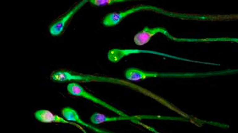 Τι μπορεί να κάνει ένας άνδρας για να έχει υγιές σπέρμα
