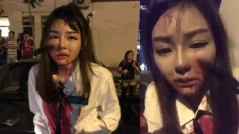 Μαχαίρωσαν έφηβη στο πρόσωπο (Προσοχή, σκληρές εικόνες!)