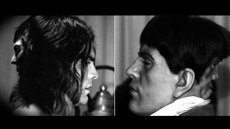 Edward Mordrake: Ο άνθρωπος με τα δύο πρόσωπα!