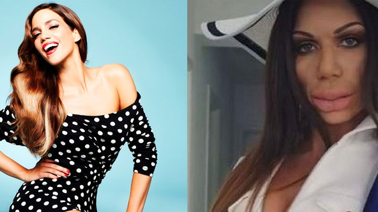 Αγνώριστη η Κατερίνα Στικούδη από τα…botox!