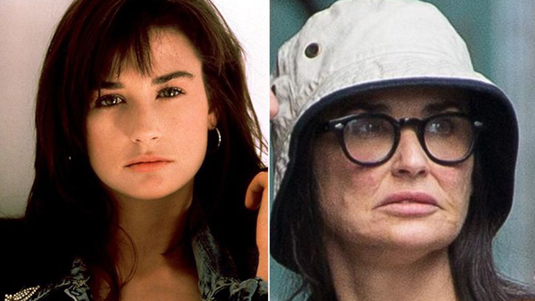 15 διάσημοι που γέρασαν άσχημα