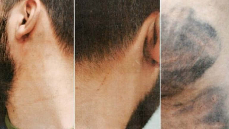 Πάτρα: Αθωώθηκαν αστυνομικοί που κατηγορούνταν για ξυλοδαρμό και βασανισμό 27χρονου