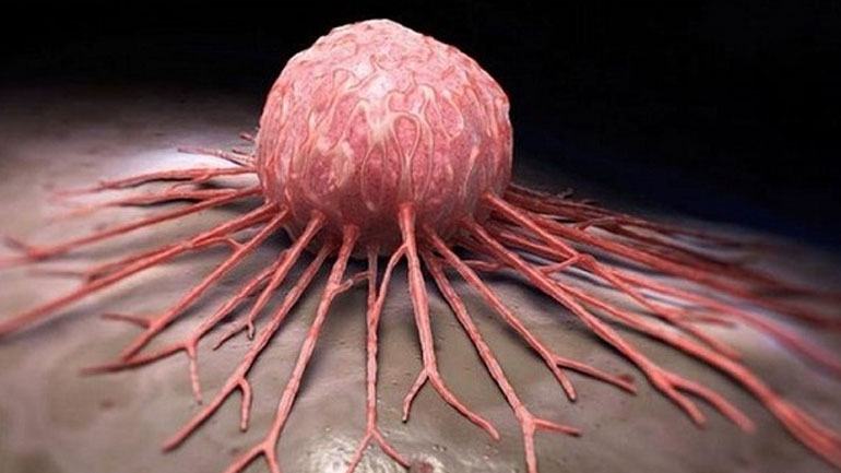 Συμπτώματα και θεραπεία της ψωρίασης των γεννητικών οργάνων