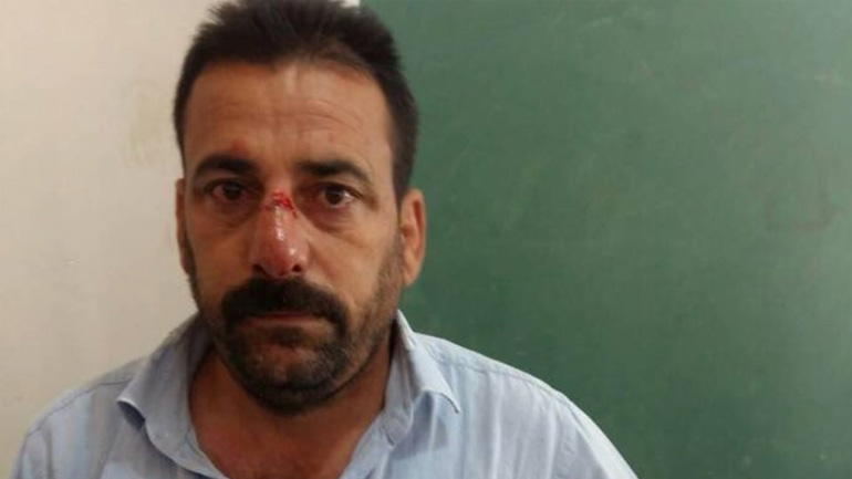 Τουρκία: Βουλευτής του Ερντογάν χτύπησε φιλοκούρδους