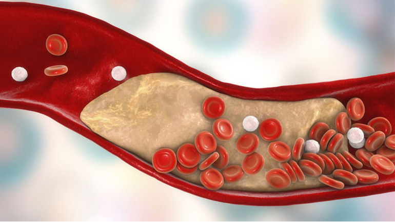 Απίστευτο: Ποιες τροφές θωρακίζουν την καρδιά, ξεβουλώνουν τις αρτηρίες και μειώνουν το βάρος
