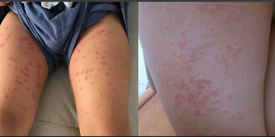 Φωτογραφία λουόμενων από τα μέσα κοινωνικής δικτύωσης