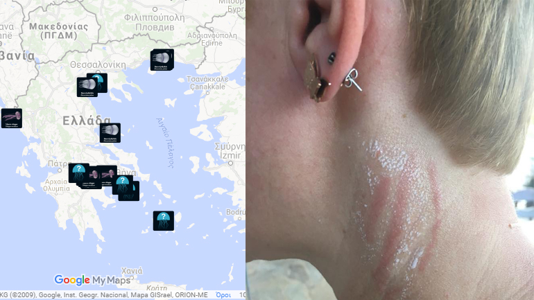 Αυξάνονται οι εμφανίσεις μεδουσών στις ελληνικές θάλασσες τον Ιούλιο