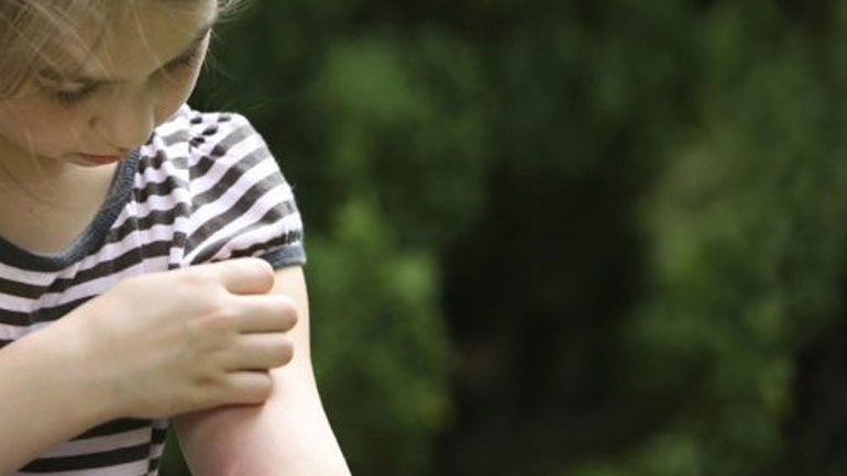 Πώς να προστατευτείτε από τα κουνούπια