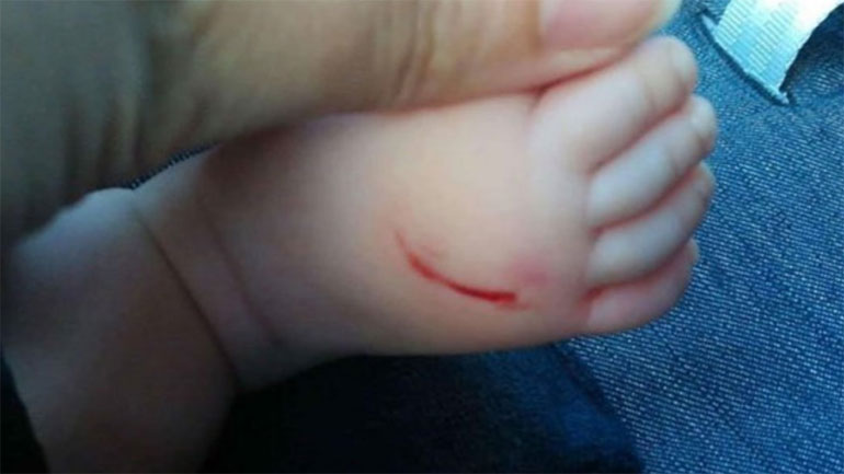 Συνελήφθη γυναίκα που χαράκωνε βρέφη σε εμπορικό κέντρο της Αττικής Συνελήφθη γυναίκα που χαράκωνε βρέφη σε εμπορικό κέντρο της Αττικής