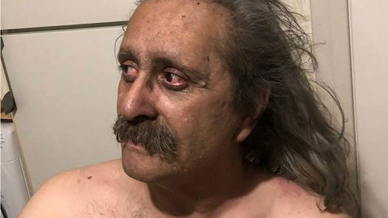 Συγκλονίζει η ανάρτηση ενός τυφλού επιζήσαντα στο Μάτι